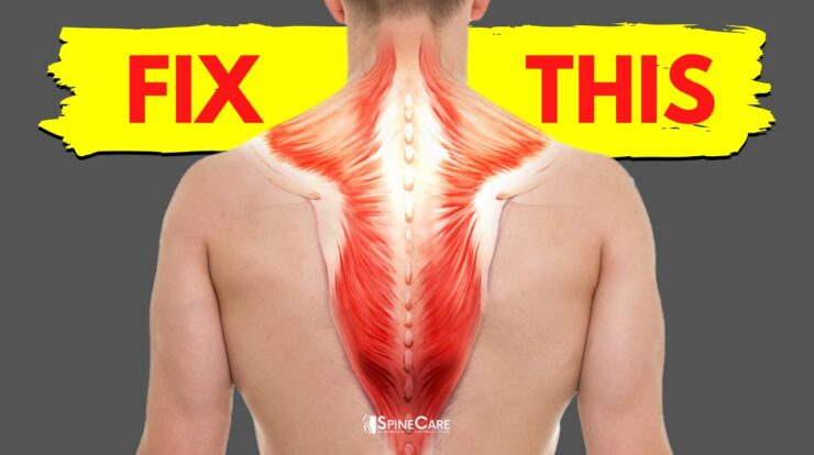 How can stiff and tight muscles result in back pain?